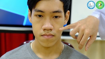 Cách xác định vị trí các huyệt thường dùng vùng đầu mặt