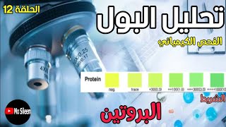 Urinalysis 12 chemical ex (Protein) dipstick