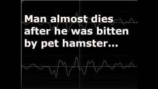 Nathan Halliday was almost killed by his own pet hamster after it bit him...