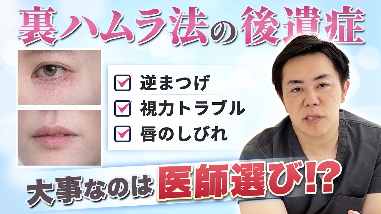 【裏ハムラ法】後悔しないために知っておくべき後遺症やリスクを医師が解説