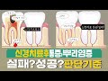 치아신경치료후 통증ㅣ 성공 OR 실패! 판단 기준 및 뿌리염증 재신경치료