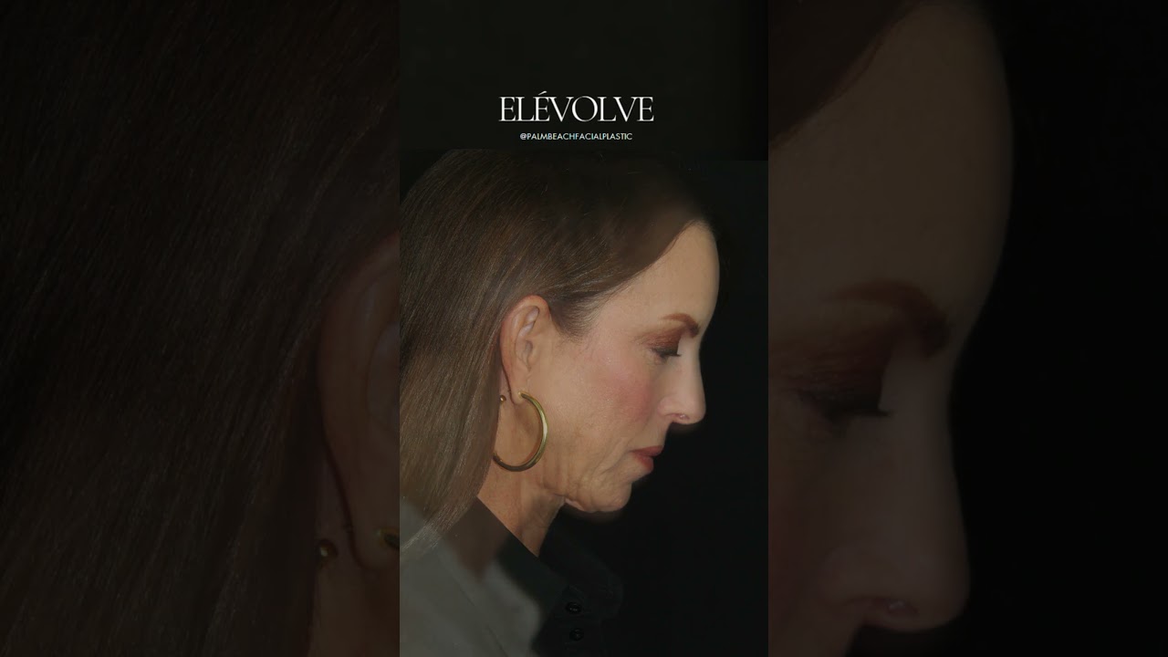 Elevate your glow with Elévolve here only at Palm Beach Facial Plastic! 