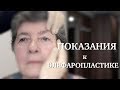 Блефаропластика // Показания