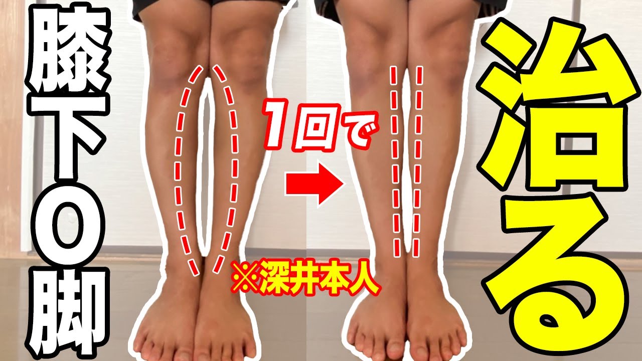 膝下o脚の治し方 おーきゃくの治し方 膝下o脚矯正ストレッチで身長を伸ばす方法 Youtube