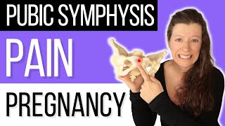 Top strategies for pubic symphysis pain in pregnancy