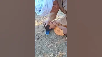 خلع الضرس 