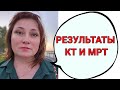 В Питере послали на Гамма-нож по результатам  МРТ. Результаты КТ