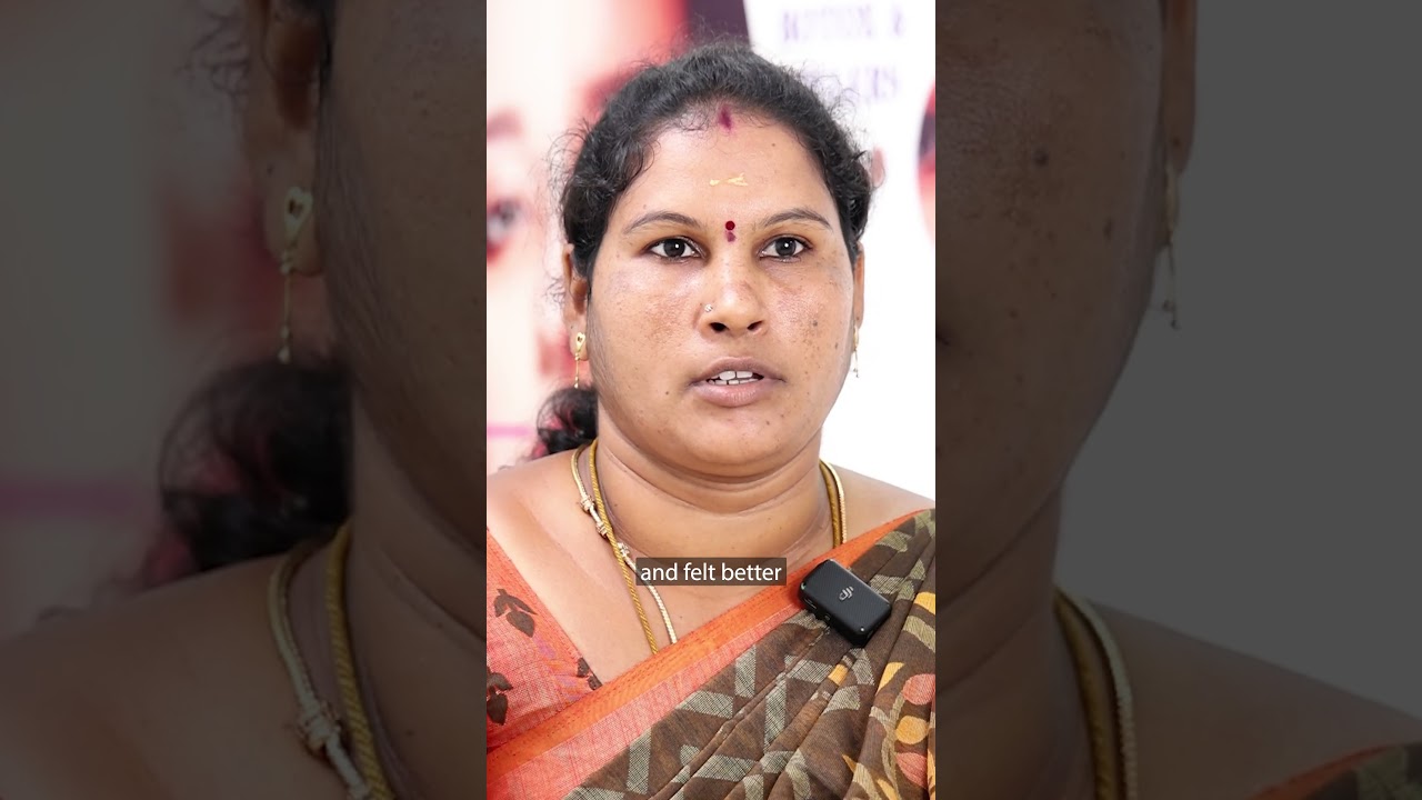 From Pigmentation to Radiance with VCare’s Q – Switch laser treatment!