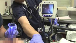 Difficult Airways With Video Laryngoscopes