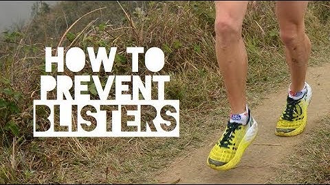 5 Tips to Stay Blister Free When Running | How to Prevent Blisters