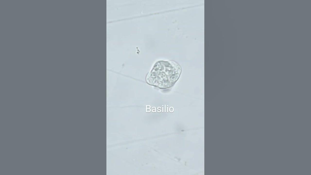 Entamoeba histolytica YouTube