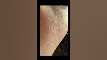 Stay consistant with my Skincare routines, and slugging 2 to 3 times ? #foryou #fyp #fypシ #skincare