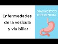 Diagnóstico Diferencial. Enfermedades de la vesícula y vía biliar