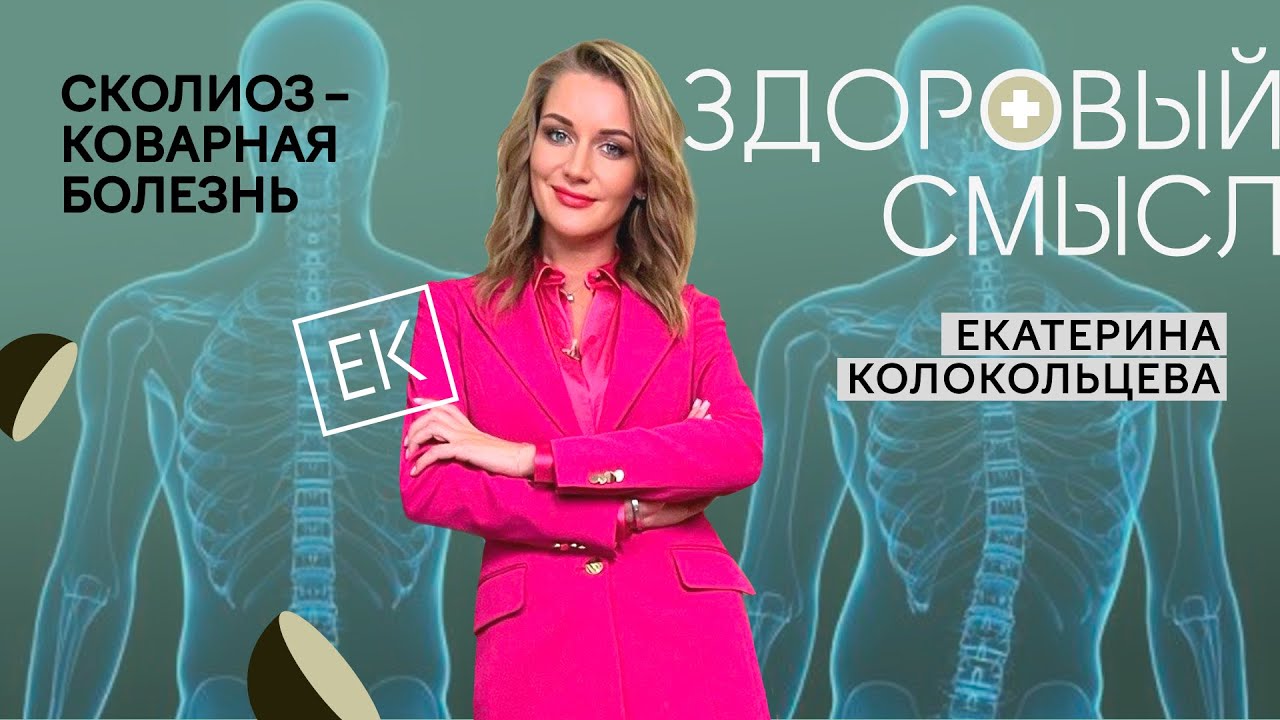 Сколиоз: причины, диагностика и лечение / Екатерина Колокольцева - YouTube
