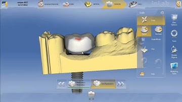 inLAB 4.0  Correcting error in abutment split file