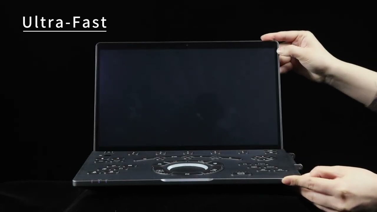 Ecograf ultraportabil Chison SonoAir 30, eco