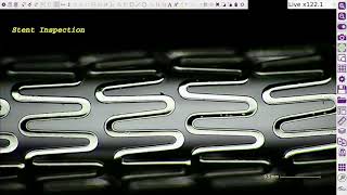 OMNI Core Application: Inspecting a Stent