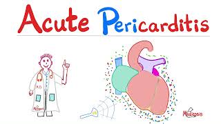 Acute Pericarditis, Pericardial Effusions, Dressler Syndrome - Cardiology Series