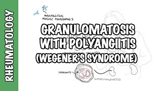Granulomatosis with Polyangiitis (pathophysiology,  symptoms, treatment)