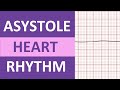 Understanding Asystole