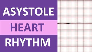 Asystole Heart Rhythm ECG Causes, Treatment Nursing NCLEX Review EKG Flatline