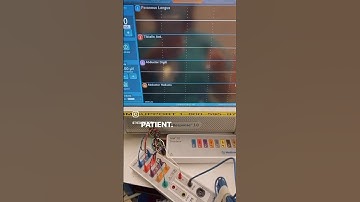 Using a NIM’s simulator