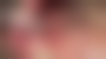 Immediate Loading Video 2 - Noris Medical