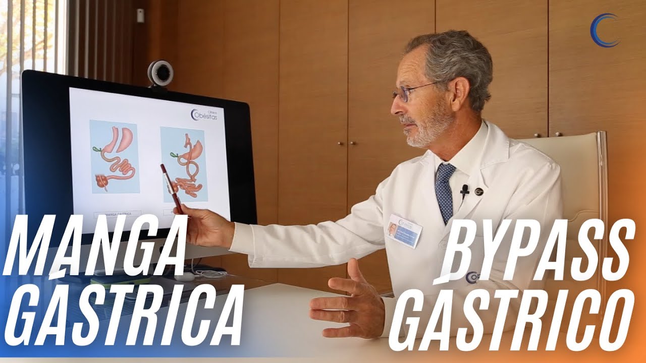 ¿MANGA GÁSTRICA o BYPASS GÁSTRICO? CIRUJANO BARIÁTRICO le explica la principal diferencia.