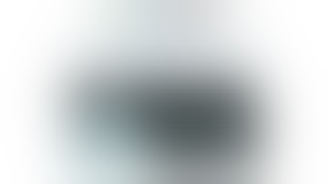 Osteotomy Week 9: June 13: M Bernstein, The Ilizarov method for tibial Malunion/Nonunion