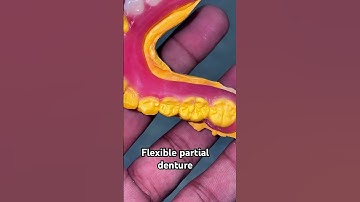 Flexible partial denture 😬😬😬#dentist #apexdental #splittooth #partialdenture #orthodontist