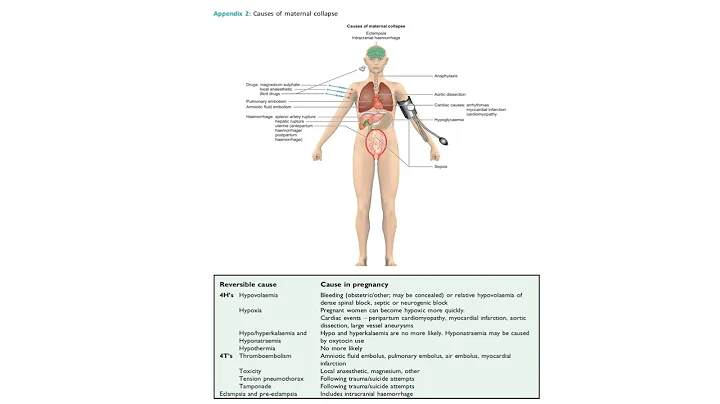 Maternal collapse in pregnancy l Greentop guideline | MRCOG Part 2