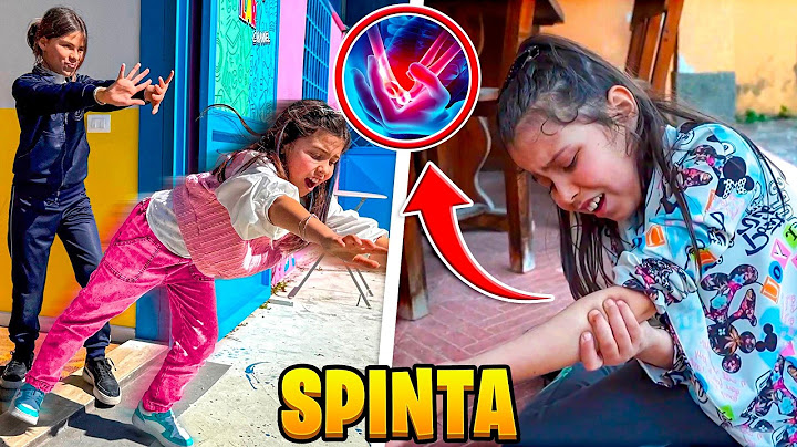 ILARY SI È ROTTA IL BRACCIO PERCHÈ LA NUOVA SORELLA CATTIVA LA SPINGE DALLE SCALE!
