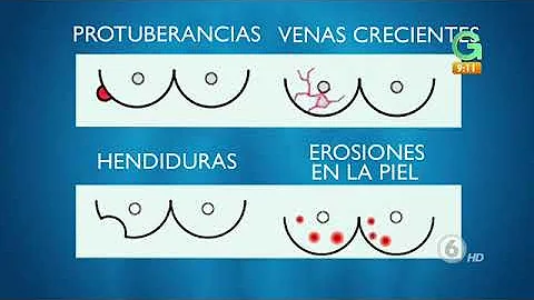 ¿Cambia la areola con la edad?