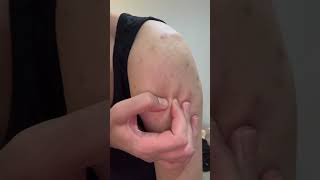 #waxing #ingrownhair #trending #asmr #hair #remove #beard #hairremoval #maazsafder #natural NK.086
