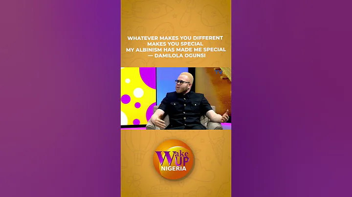 My Albinism Has Made Me Special- Damilola Ogunsi