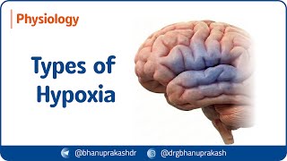 17. Types Of Hypoxia Hypoxic, Anemic, Stagnant & Histotoxic Hypoxia Usmle Step 1