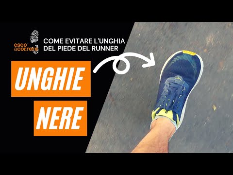 Unghie nere e perdita delle unghie nella corsa