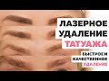 Лазерное удаление татуажа. Можно ли удалить татуаж быстро, качественно и БЕСПЛАТНО?