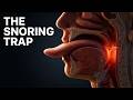 The Real Reason Your Tongue Shape Causes Choking & Snoring 😮