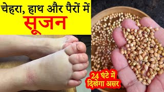 Causes and home remedies for swollen face, hands, and feet. See results within 24 hours. screenshot 5