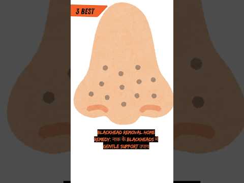 3 Best Blackhead Removal Home Remedy: नाक के blackheads में gentle support उपाय 🧼