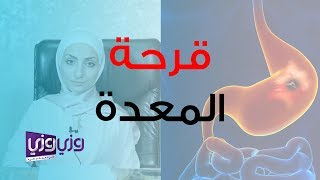 أعراض قرحة المعدة وأسبابها