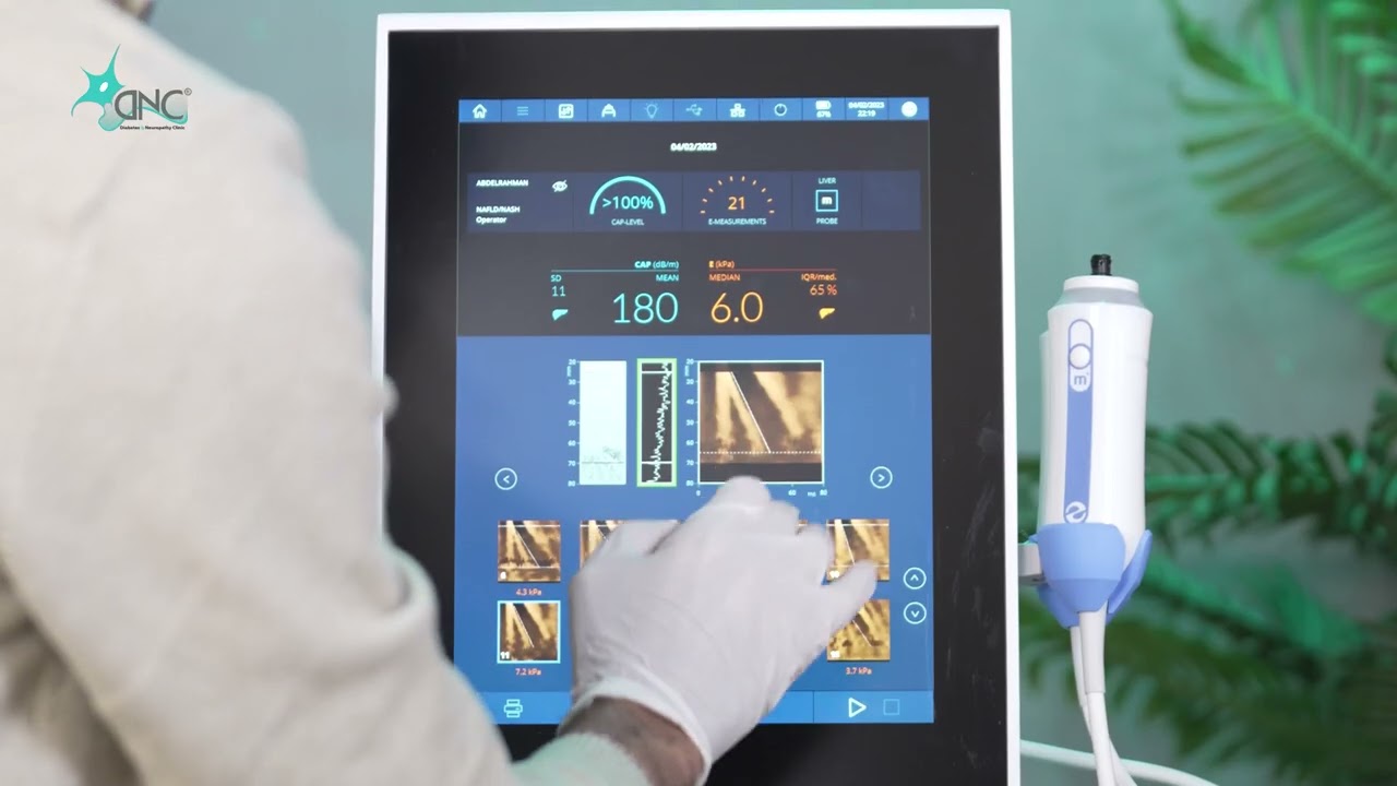 أهمية الفحص بجهاز الفايبروسكان للكشف عن الكبد الدهني السكري وتليف الكبد مع د/ أحمد حجاج