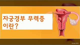 자궁경부무력증 이란