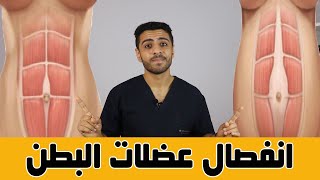 انفصال عضلات البطن بعد الولاده (الاختبار,تمارين العلاج,التمارين الخاطئه لتجنبها)