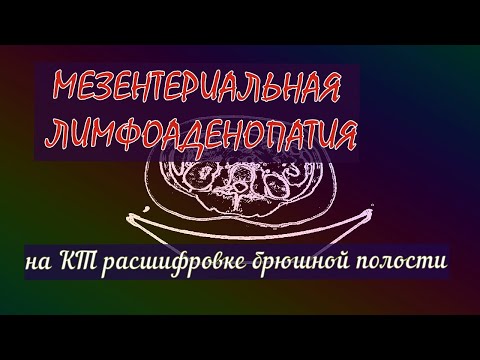 Wideo: Wpływ Mikroplastików I Zasolenia Na Przetwarzanie Odpadów Spożywczych Przez Larwy Muchy Czarnego żołnierza (Hermetia Illucens)