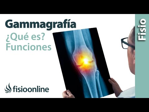 Video: Cómo comprender los resultados de una gammagrafía ósea: 13 pasos