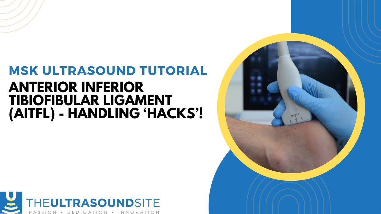 Anterior inferior tibiofibular ligament (AITFL) handling hacks and tips ...