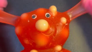 Cherry The Gummy Bears Acne Problem Lets Help Her Full Video- Xtractiveasmr