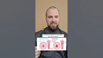 Что лучше: Пульмикорт или Беродуал?